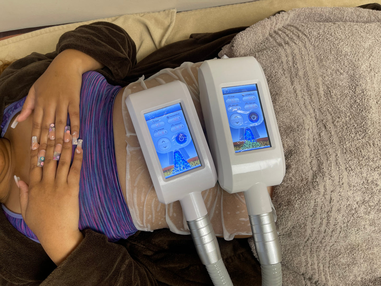 Booking Room 4 - Fat freeze